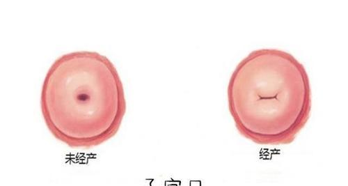 以须产怎么恢复快视频（学习以须产快速恢复的有效方法）
